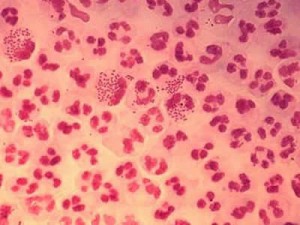 Gonorrhea Virus