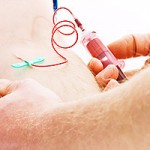 HIV Test